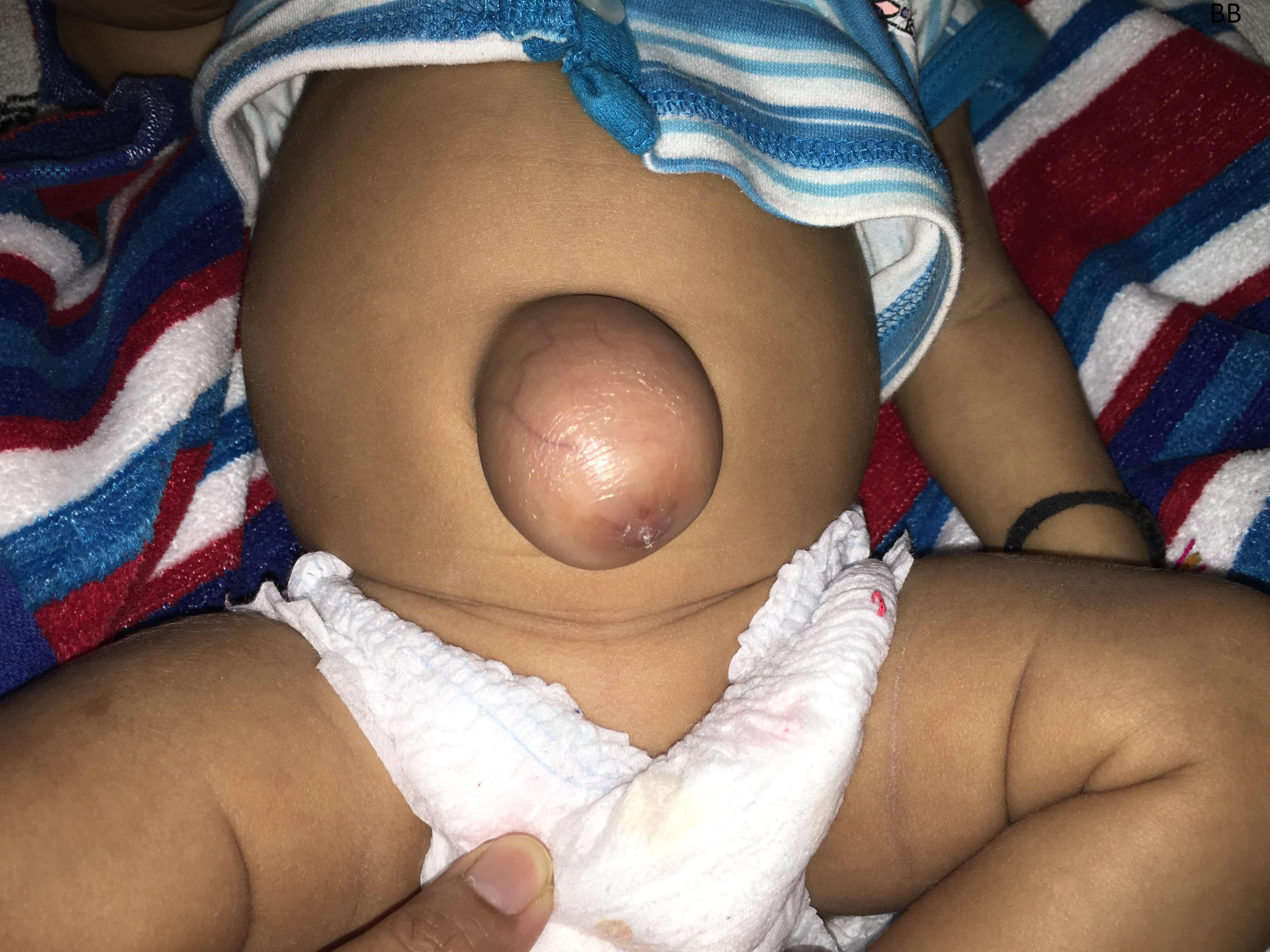 Pediatric General Surgery Image 9